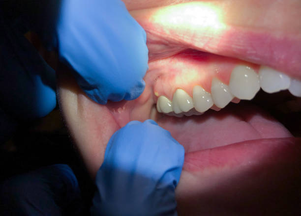 Best After-Hours Emergency Dentist in Yardville, NJ